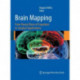 Brain Mapping: From Neural Basis of Cognition to Surgical Applications