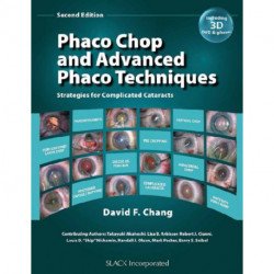 Phaco Chop and Advanced Phaco Techniques: Strategies for Complicated Cataracts