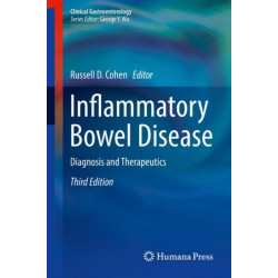 Inflammatory Bowel Disease: Diagnosis and Therapeutics