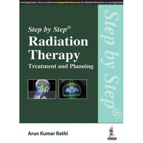 Step by Step Radiation Therapy: Treatment and Planning