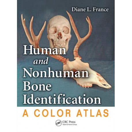Human and Nonhuman Bone Identification: A Color Atlas