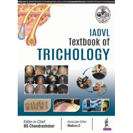 IADVL Textbook of Trichology