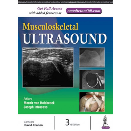 Musculoskeletal Ultrasound
