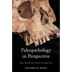 Paleopathology in Perspective: Bone Health and Disease through Time