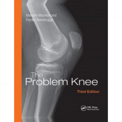 The Problem Knee