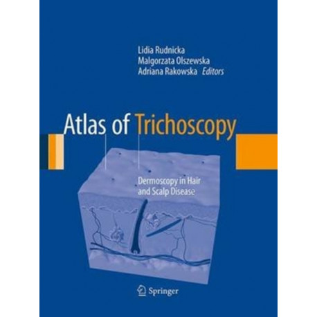 Atlas of Trichoscopy: Dermoscopy in Hair and Scalp Disease
