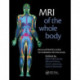 MRI of the Whole Body: An Illustrated Guide for Common Pathologies