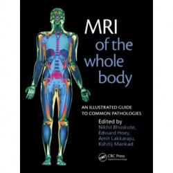 MRI of the Whole Body: An Illustrated Guide for Common Pathologies
