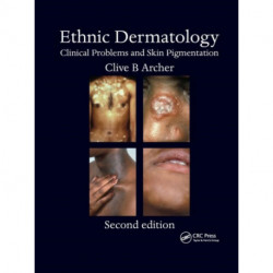 Ethnic Dermatology: Clinical Problems and Skin Pigmentation