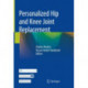 Personalized Hip and Knee Joint Replacement