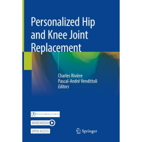 Personalized Hip and Knee Joint Replacement