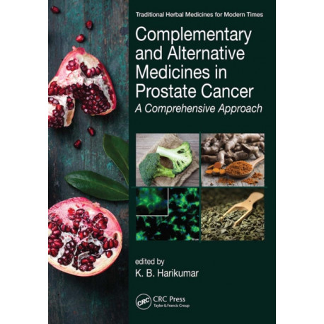 Complementary and Alternative Medicines in Prostate Cancer: A Comprehensive Approach