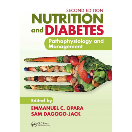 Nutrition and Diabetes: Pathophysiology and Management