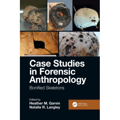 Case Studies in Forensic Anthropology: Bonified Skeletons