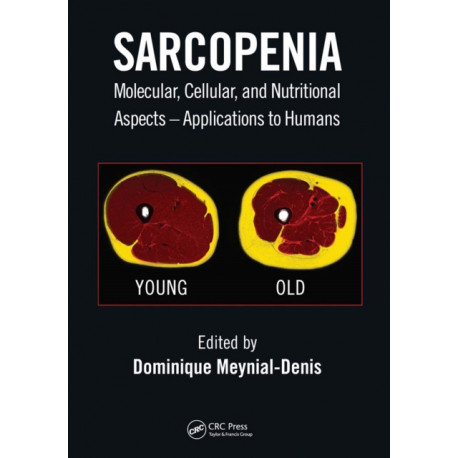 Sarcopenia: Molecular, Cellular, and Nutritional Aspects – Applications to Humans