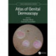 Atlas of Genital Dermoscopy