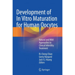 Development of In Vitro Maturation for Human Oocytes: Natural and Mild Approaches to Clinical Infertility Treatment
