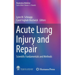 Acute Lung Injury and Repair: Scientific Fundamentals and Methods