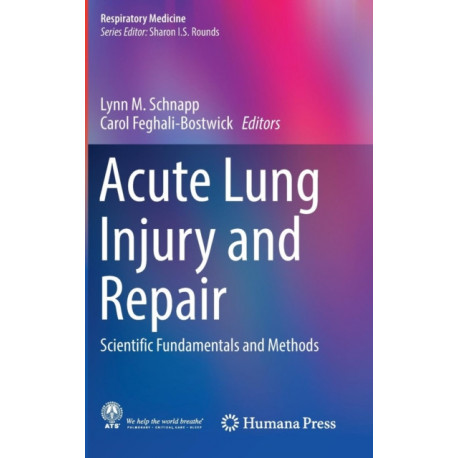 Acute Lung Injury and Repair: Scientific Fundamentals and Methods