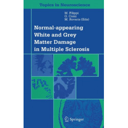 Normal-appearing White and Grey Matter Damage in Multiple Sclerosis