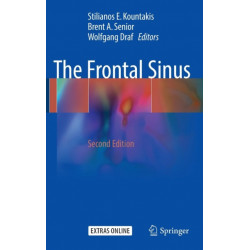 The Frontal Sinus