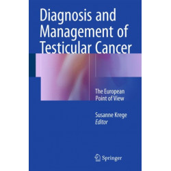 Diagnosis and Management of Testicular Cancer: The European Point of View