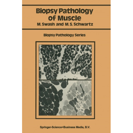 Biopsy pathology of muscle