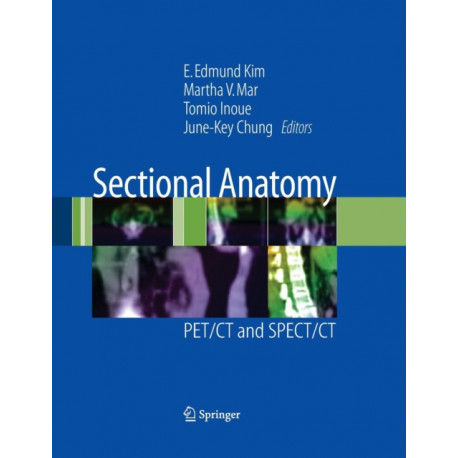 Sectional Anatomy: PET/CT and SPECT/CT