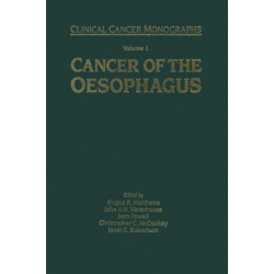 Cancer of the Oesophagus