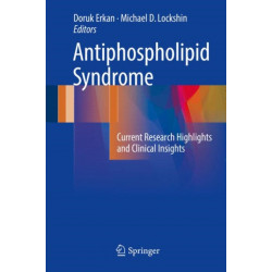 Antiphospholipid Syndrome: Current Research Highlights and Clinical Insights