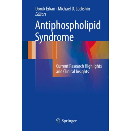 Antiphospholipid Syndrome: Current Research Highlights and Clinical Insights