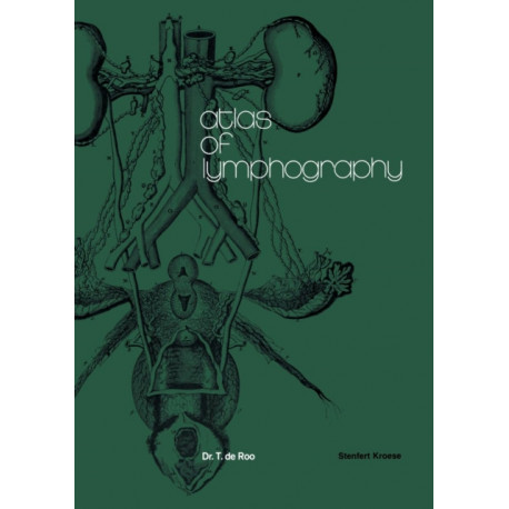 Atlas of Lymphography
