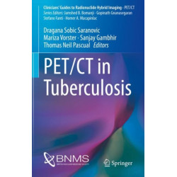 PET/CT in Tuberculosis