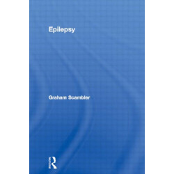 Epilepsy