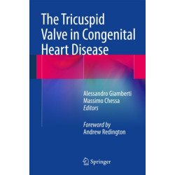 The Tricuspid Valve in Congenital Heart Disease