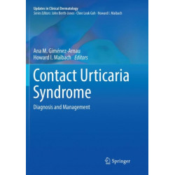 Contact Urticaria Syndrome: Diagnosis and Management