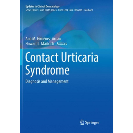 Contact Urticaria Syndrome: Diagnosis and Management