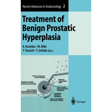 Treatment of Benign Prostatic Hyperplasia