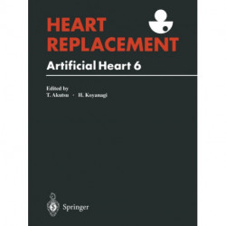 Heart Replacement: Artificial Heart 6