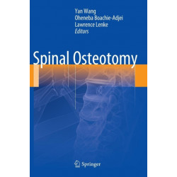 Spinal Osteotomy