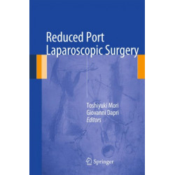 Reduced Port Laparoscopic Surgery