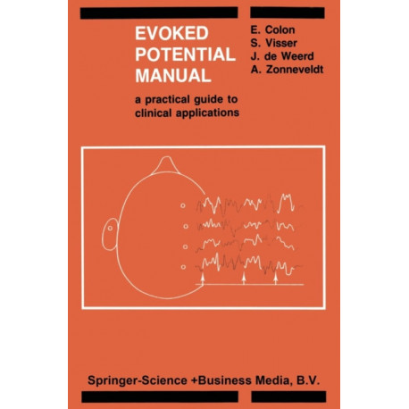 Evoked Potential Manual: A Practical Guide to Clinical Applications