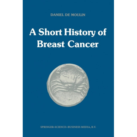 A short history of breast cancer
