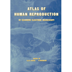 Atlas of Human Reproduction: By Scanning Electron Microscopy