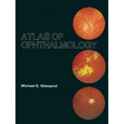 Atlas of Ophthalmology