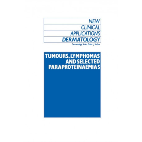 Tumours, Lymphomas and Selected Paraproteinaemias