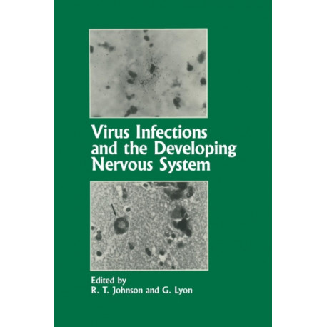 Virus Infections and the Developing Nervous System