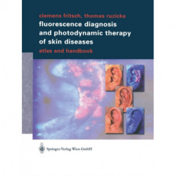Fluorescence Diagnosis and Photodynamic Therapy of Skin Diseases: Atlas and Handbook