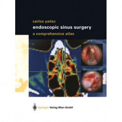 Endoscopic Sinus Surgery: A Comprehensive Atlas