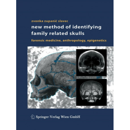 New Method of Identifying Family Related Skulls: Forensic Medicine, Anthropology, Epigenetics